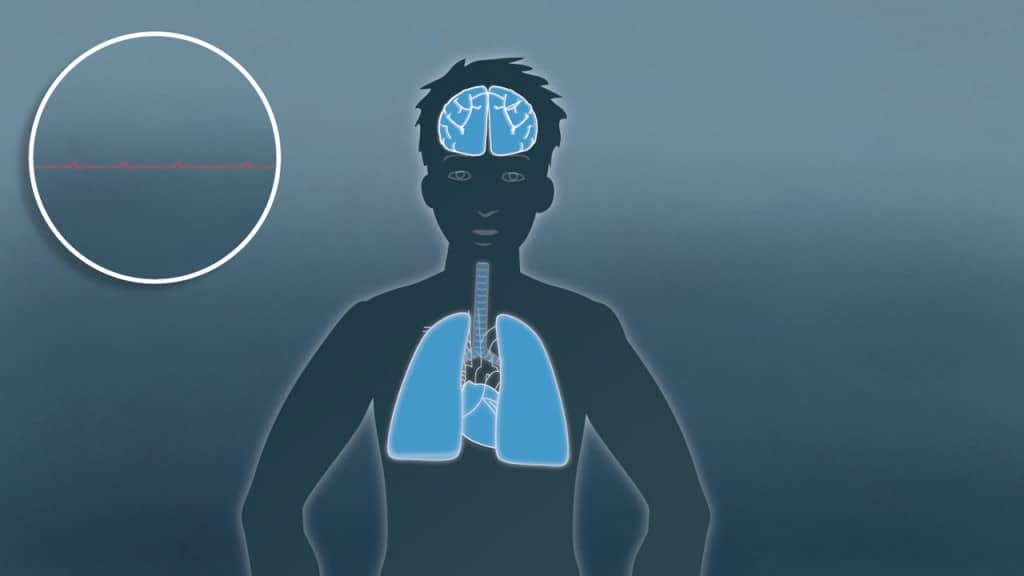 Effects of hypothermia on the body
